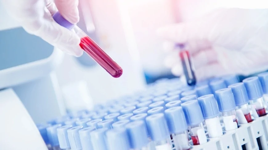 Longevità e prevenzione: 6 indicatori da esami del sangue