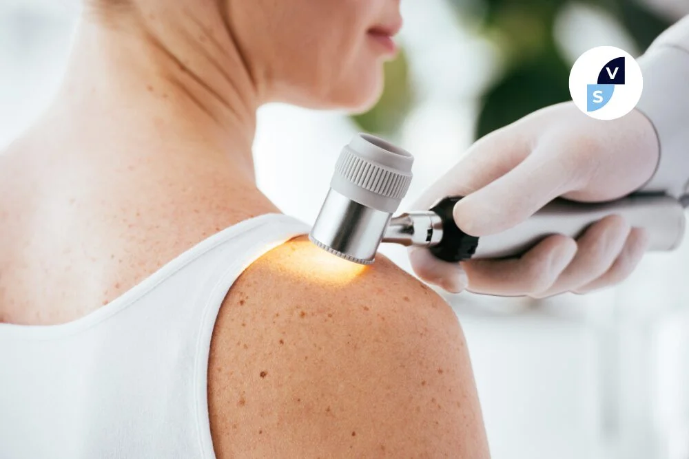Nasce la Giornata Nazionale per la Prevenzione del Melanoma: approvata la legge in Parlamento